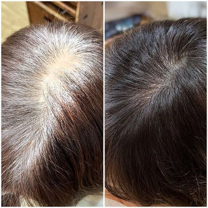 InstaNegro® - Shampoo Tingidor Instantâneo para Cabelos Pretos